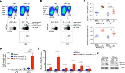 Dependence on Autophagy for Autoreactive Memory B Cells in the Development of Pristane-Induced Lupus